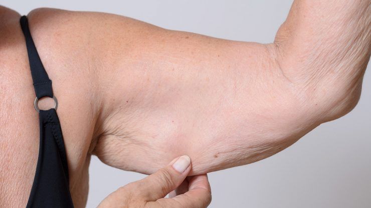 Sarcopenia (Muscle Loss)