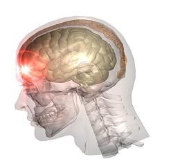 Traumatic Brain Injury