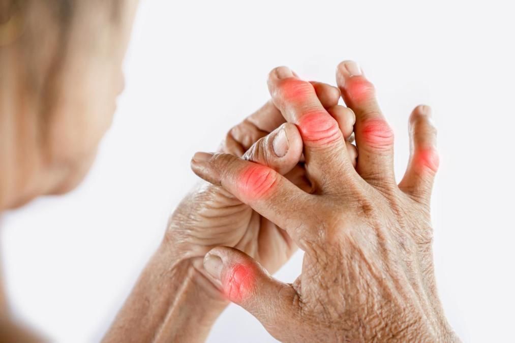 Age-Related Arthritis
