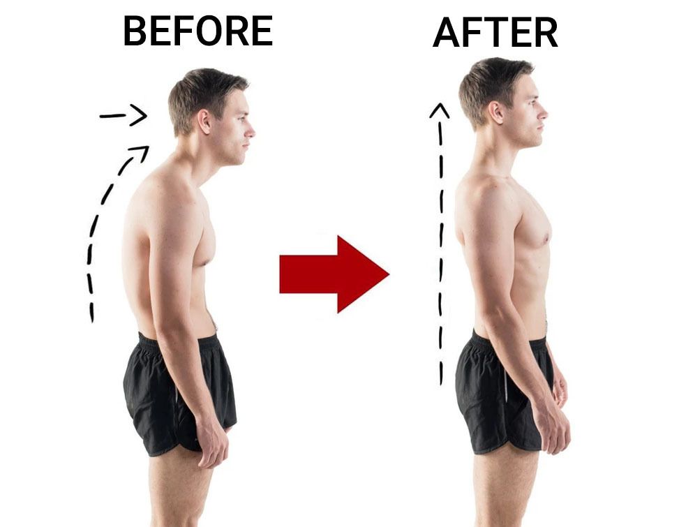Postural Correction