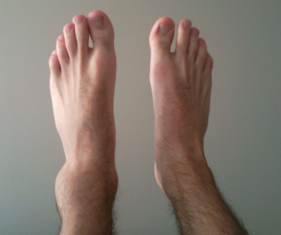 Ankle Instability & Sprains